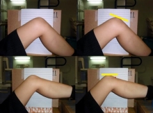 2）膝蓋骨の角度（側面から）