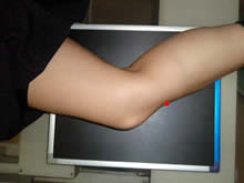 照射位置は、脛骨結節の皮膚表面側を中心とする。